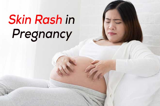 Skin Rash in Pregnancy